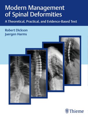 cover image of Modern Management of Spinal Deformities